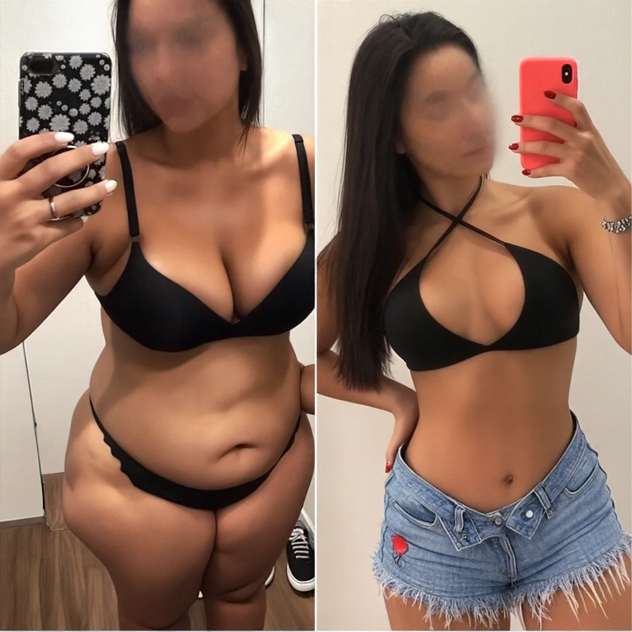 Paired before-and-after photographs of Mara, with her face blurred in both views